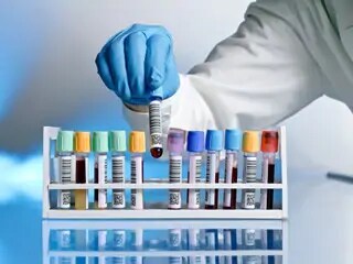Diagnosticar infecção urinária Diagnosticar infecção urinária