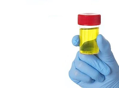 Infecção Urinária Infecção Urinária