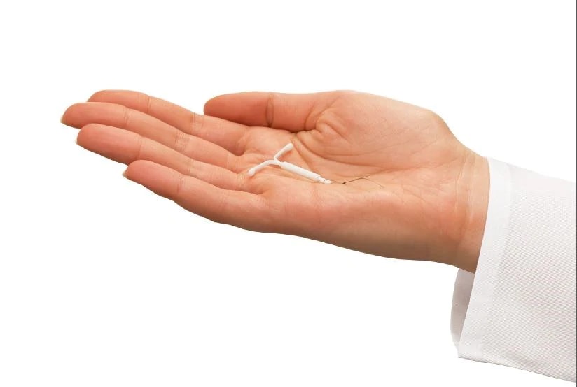 Métodos contraceptivos de Longo Prazo: Quais são os reais benefícios para as pacientes? Métodos contraceptivos de Longo Prazo: Quais são os reais benefícios para as pacientes?