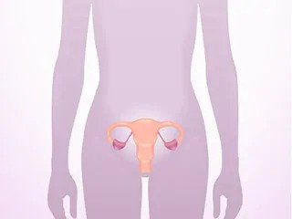 Tricomoníase é uma infecção genital Tricomoníase é uma infecção genital