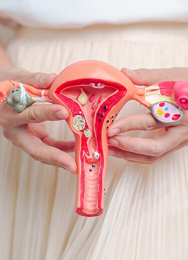 endometriose