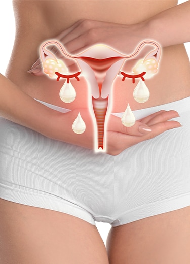 Métodos Contraceptivos Infecções vaginais